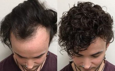 Basic knowledge of men's custom toupee hair