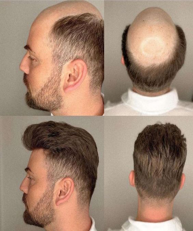 Mens toupee hairpiece system human hair unit for men sale online
